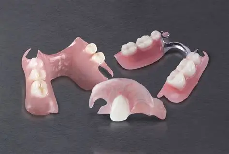 Removable partial dentures